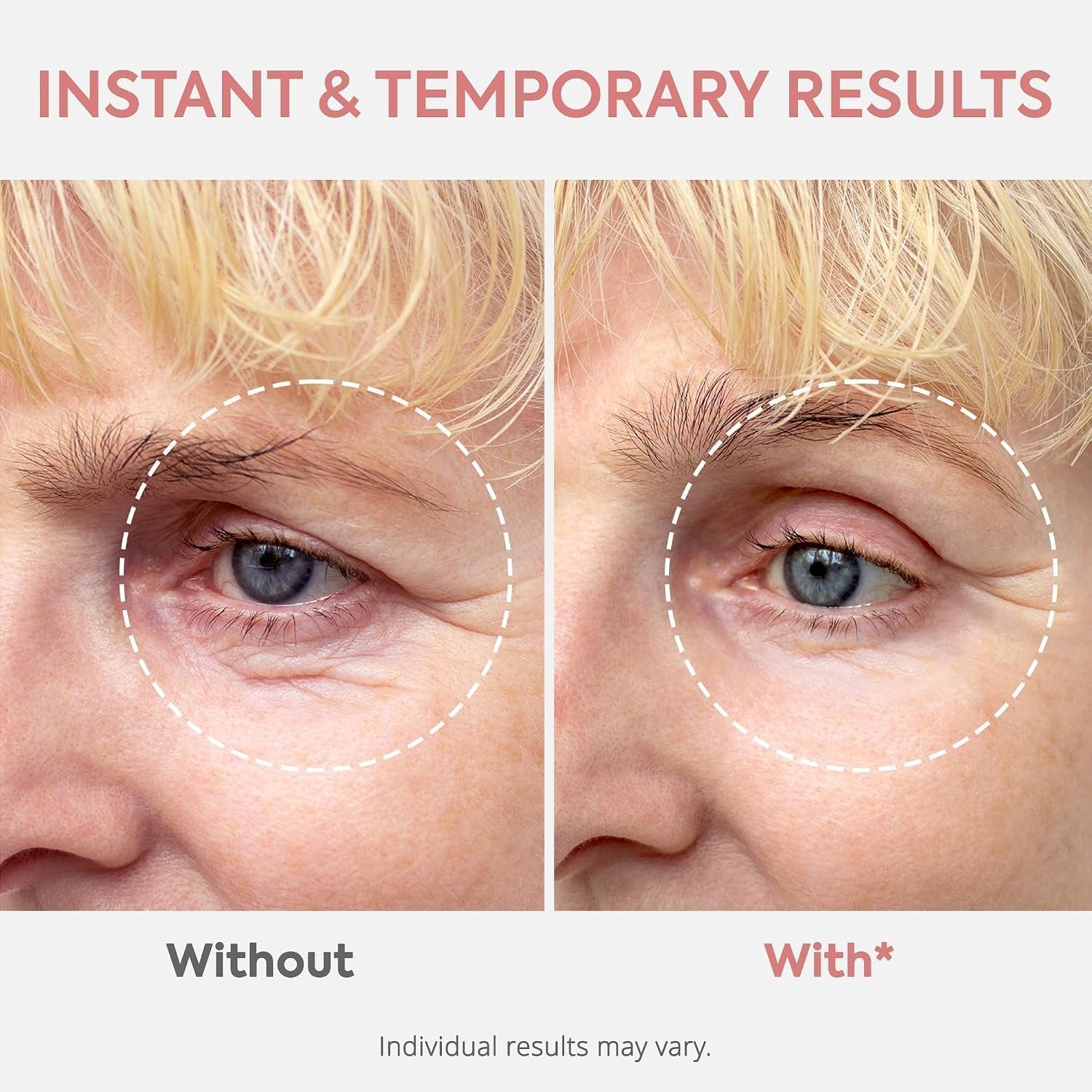Instant Eye & Face Lift Cream: Rapid under Eye Bags Wrinkle Smile Lines Forehead Lines Remover - Temporary Firming & Tightening Treatment in 2 Minutes, 1 Fl. Oz.